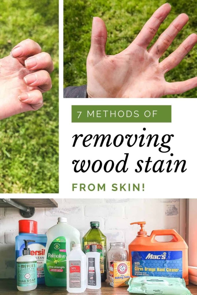 image collage of hands with gel stain on them and collection of products on wood counter top with text overlay " 7 methods of removing wood stain from skin!"