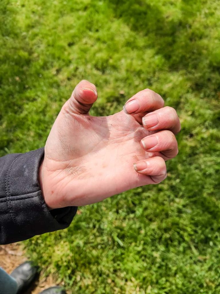 Woman's hand showing gel stain on her fingernails.